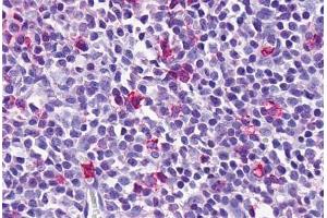 Anti-EMR3 antibody  ABIN1048550 IHC staining of human spleen, lymphocytes. (EMR3 anticorps  (N-Term))