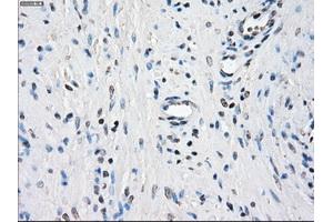 Image no. 9 for anti-Budding Uninhibited By Benzimidazoles 1 Homolog beta (Yeast) (BUB1B) antibody (ABIN1496996) (BUB1B anticorps)