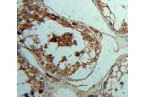 Used in DAB staining on fromalin fixed paraffin-embedded Testis tissue (PTH2R anticorps  (AA 27-145))