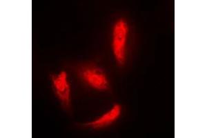 Immunofluorescent analysis of Histone Deacetylase 5 staining in HeLa cells.