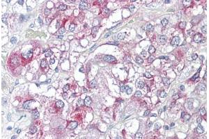 Anti-KCNH3 antibody IHC staining of human adrenal.