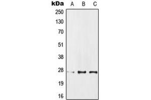 Western blot analysis of IPP1 expression in MCF7 (A), SP2/0 (B), PC12 (C) whole cell lysates. (PPP1R1A anticorps  (Center))