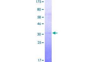 SDS-PAGE (SDS) image for High Mobility Group Box 2 (HMGB2) (AA 1-209) protein (His-DYKDDDDK-Strep II Tag) (ABIN4369871)