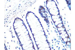 Immunohistochemistry of paraffin-embedded human colon using 14-3-3 sigma Rabbit mAb (ABIN7270602) at dilution of 1:100 (40x lens).