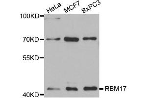 Western Blotting (WB) image for anti-RNA Binding Motif Protein 17 (RBM17) antibody (ABIN1875451) (RBM17 anticorps)