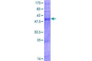 Image no. 1 for Taste Receptor, Type 2, Member 9 (TAS2R9) (AA 1-312) protein (GST tag) (ABIN1322185)