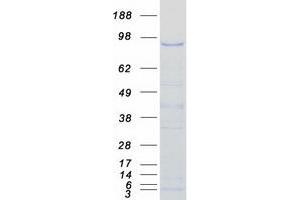 Validation with Western Blot