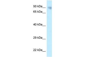 WB Suggested Anti-PPP6R3 Antibody Titration: 1. (PPP6R3 anticorps  (N-Term))