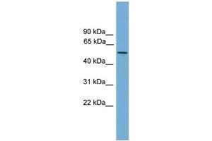 Human NCI-H226; WB Suggested Anti-EFCAB3 Antibody Titration: 0. (EFCAB3 anticorps  (N-Term))