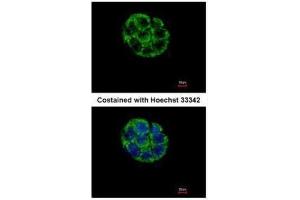 ICC/IF Image Immunofluorescence analysis of methanol-fixed Hep G2, using ASB5, antibody at 1:500 dilution. (ASB5 anticorps)