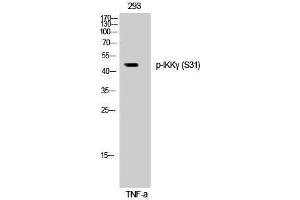 Western Blotting (WB) image for anti-Inhibitor of kappa Light Polypeptide Gene Enhancer in B-Cells, Kinase gamma (IKBKG) (pSer31) antibody (ABIN3182524)