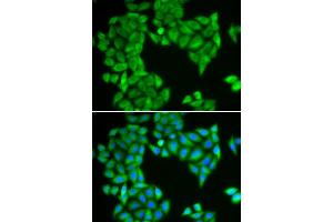 Immunofluorescence analysis of HeLa cells using SPAG5 antibody (ABIN6290586). (SPAG5 anticorps)