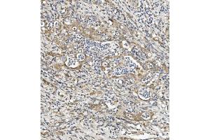IHC analysis of Sema6A using anti-Sema6A antibody (ABIN7601261).