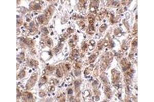 Immunohistochemistry of THEM2 in human liver tissue with this product at 2. (THEM2 anticorps  (C-Term))