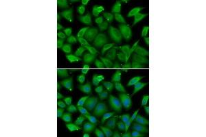 Immunofluorescence analysis of HeLa cells using DEFA1 antibody. (alpha Defensin 1 anticorps  (AA 1-94))