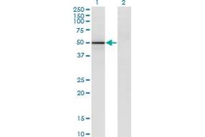 Western Blot analysis of VIL1 expression in transfected 293T cell line by VIL1 monoclonal antibody (M26), clone 2F10. (Villin 1 anticorps  (AA 1-421))
