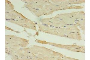 Immunohistochemistry of paraffin-embedded human skeletal muscle tissue using ABIN7146727 at dilution of 1:100 (CA5B anticorps  (AA 34-314))