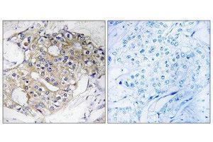 Immunohistochemistry (IHC) image for anti-Dehydrogenase/reductase (SDR Family) Member 4 (DHRS4) (C-Term) antibody (ABIN1851226) (DHRS4 anticorps  (C-Term))