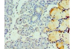 Immunohistochemistry of paraffin-embedded human pancreatic tissue using ABIN7173326 at dilution of 1:100 (TFF1 anticorps  (AA 25-84))