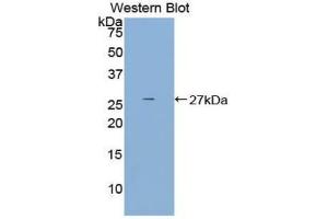 Western blot analysis of the recombinant protein. (DCL1 anticorps  (AA 21-225))