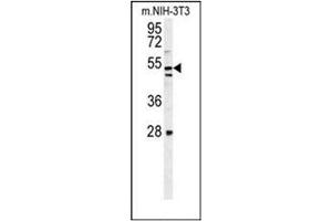 Western blot analysis of KIAA1609 Antibody (C-term) in mouse NIH-3T3 cell line lysates (35ug/lane). (KIAA1609 anticorps  (C-Term))
