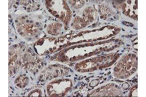 Immunohistochemical staining of paraffin-embedded Human Kidney tissue using anti-AKT1 mouse monoclonal antibody. (AKT1 anticorps)