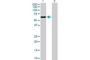 Western Blot analysis of IDH3B expression in transfected 293T cell line by IDH3B MaxPab polyclonal antibody. (IDH3B anticorps  (AA 1-385))