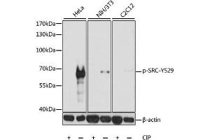 Western blot analysis of extracts of various cell lines, using Phospho-SRC-Y529 antibody. (Src anticorps  (pTyr529))
