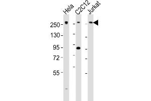 All lanes : Anti-Med12 Antibody (C-term) at 1:2000 dilution Lane 1: Hela whole cell lysates Lane 2: C2C12 whole cell lysates Lane 3: Jurkat whole cell lysates Lysates/proteins at 20 μg per lane. (MED12 anticorps  (C-Term))