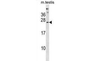 Western Blotting (WB) image for anti-Phosphatase, Orphan 2 (PHOSPHO2) antibody (ABIN3001017) (PHOSPHO2 anticorps)