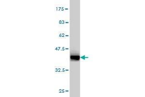 Western Blot detection against Immunogen (37. (KRT4 anticorps  (AA 194-300))