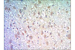 Immunohistochemical analysis of paraffin-embedded human brain tissues using KLHL21 antibody with DAB staining. (KLHL21 anticorps)
