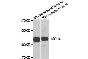 Western blot analysis of extracts of various cell lines, using MSH4 antibody (ABIN5996306) at 1/1000 dilution. (MSH4 anticorps)