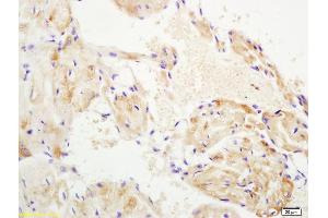 Formalin-fixed and paraffin embedded mouse heart labeled with Anti-WNT10B Polyclonal Antibody, Unconjugated (ABIN702295) at 1:200 followed by conjugation to the secondary antibody