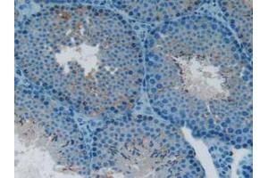IHC-P analysis of Mouse Testis tissue, with DAB staining. (LTBR anticorps  (AA 128-395))
