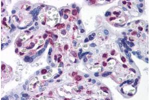 Human Placenta: Formalin-Fixed, Paraffin-Embedded (FFPE)