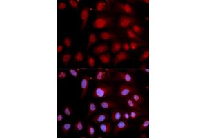 Immunofluorescence analysis of U2OS cells using POLB antibody (ABIN5970839). (POLB anticorps)