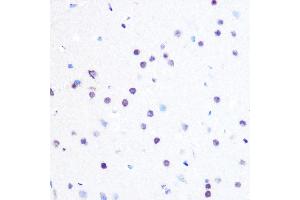 Immunohistochemistry of paraffin-embedded rat brain using PEG3 Rabbit pAb (ABIN6128527, ABIN6145434, ABIN6145435 and ABIN6216398) at dilution of 1:100 (40x lens). (PEG3 anticorps  (AA 1-300))