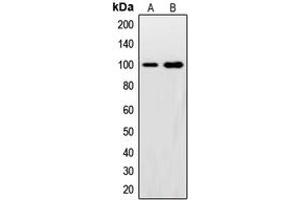 Western blot analysis of Synphilin 1 expression in HeLa (A), U2OS (B) whole cell lysates.