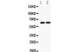 Anti- SLC22A2 Picoband antibody, Western blotting All lanes: Anti SLC22A2  at 0. (SLC22A2 anticorps  (Middle Region))