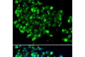 Immunofluorescence analysis of MCF-7 cells using NAT9 Polyclonal Antibody (NAT9 anticorps)