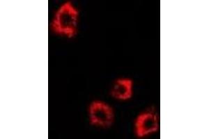 Immunofluorescent analysis of DDX58 staining in HepG2 cells. (DDX58 anticorps)