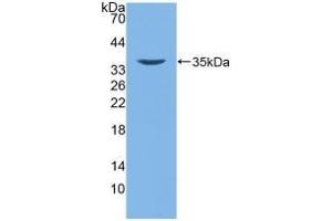 Detection of Recombinant DEFb2, Human using Polyclonal Antibody to Defensin Beta 2 (DEFb2) (beta 2 Defensin anticorps  (AA 24-64))