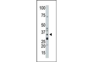 Image no. 1 for anti-Protein Phosphatase 1, Catalytic Subunit, beta Isoform (PPP1CB) (C-Term) antibody (ABIN360761)