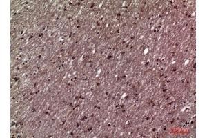 Immunohistochemical analysis of paraffin-embedded human-brain, antibody was diluted at 1:100. (HSD11B1 anticorps  (N-Term))