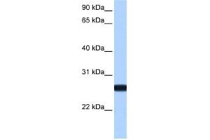 WB Suggested Anti-IL13RA2 Antibody Titration: 0. (IL13RA2 anticorps  (N-Term))