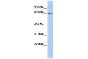 Western Blot showing ZNF619 antibody used at a concentration of 1-2 ug/ml to detect its target protein. (ZNF619 anticorps  (N-Term))