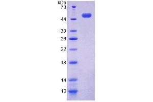 SDS-PAGE analysis of Human ACP6 Protein. (ACP6 Protéine)