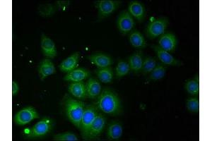 Immunofluorescent analysis of A549 cells using ABIN7142715 at dilution of 1:100 (TROVE2 anticorps  (AA 3-535))