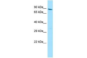 WB Suggested Anti-YTHDC1 Antibody Titration: 1. (YTHDC1 anticorps  (N-Term))